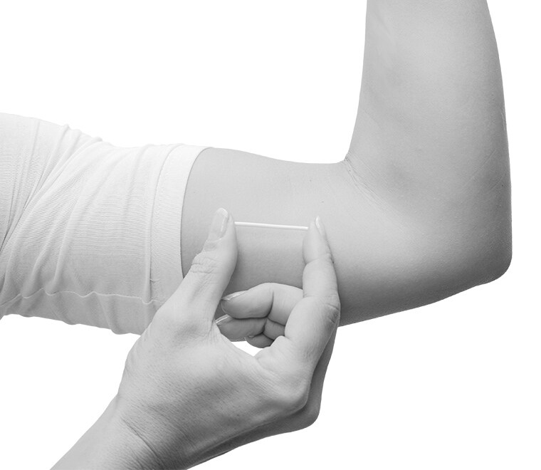 Implant Implant